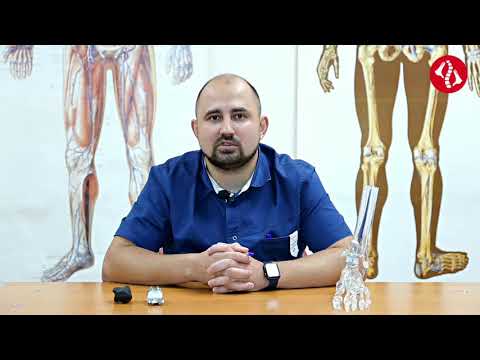 Видео: Ахиллово сухожилие: что делать при разрыве?