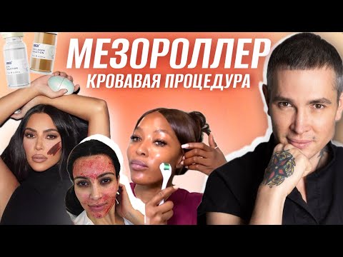 Видео: Как правильно использовать МЕЗОРОЛЛЕР? Кровавая процедура. Вся правда про #мезороллер