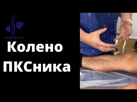 Видео: СОСТОЯНИЕ ПОСЛЕ ПЛАСТИКИ ПКС | Частые Проблемы