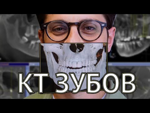 Видео: Что такое КТ зубов? Для чего нужно и как делают?