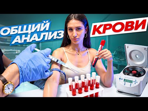 Видео: ЧТО ПОКАЗЫВАЕТ ОБЩИЙ АНАЛИЗ КРОВИ?