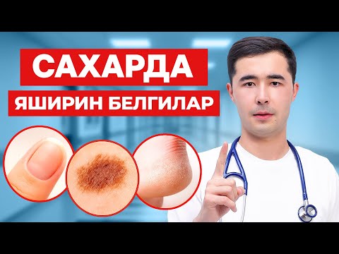 Видео: КАНДЛИ ДИАБЕТ ШУНДАЙ БОШЛАНАДИ. САХАФАРДА ЯШИРИН ИЛК БЕЛГИЛАР ВА ДАВОЛАШ