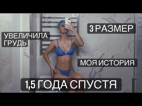 Видео: МОЯ МАММОПЛАСТИКА: МИНУСЫ, ЦЕНА, ВЫБОР ХИРУРГА
