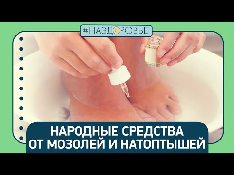 Видео: #НАЗДОРОВЬЕ: народные средства от мозолей