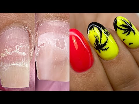 Видео: Ногтям 9 недель😱Ну сколько можно😐Причины отслоек💅Быстрый дизайн ногтей💅маникюр