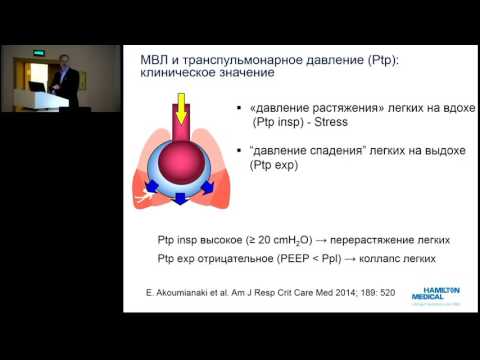 Видео: Мониторинг транспульмонарного давления  27.05.17.  Сатишур О.Е.