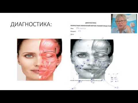 Видео: Диагностика. Мануальная пластика лица по методу Сплитмассаж Ларисы Витвиновой. Запись вебинара
