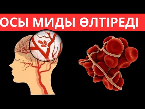 Видео: Миды тез ӨЛТІРЕТІН 3-Тағам. Бас ауырғанда не істеу керек басты ауыртуға алып келетін нақты 3 қателік