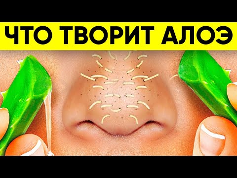 Видео: ВОТ ЧТО ТВОРИТ АЛОЭ! (Реальная Польза и Вред Алоэ Вера)