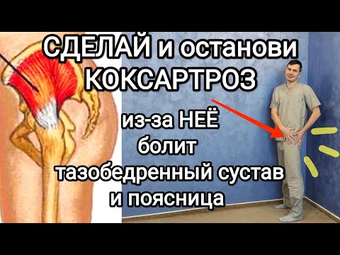 Видео: Сделай и останови КОКСАРТРОЗ / из-за этой мышцы болит тазобедренный сустав и поясница + перекос таза