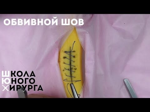 Видео: непрерывный обвивной шов (техника; как наложить)
