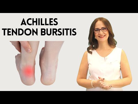 Видео: Вы страдаете бурситом ахиллова сухожилия?