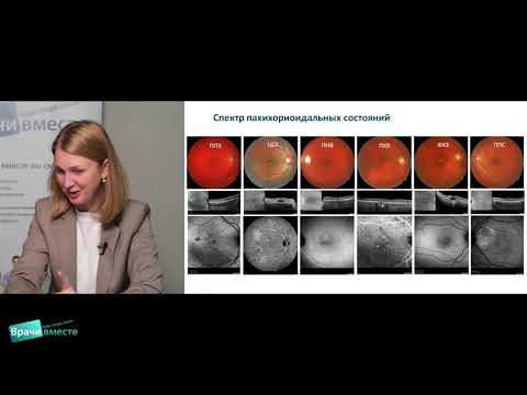 Видео: Онлайн-лекция "Пахихориоидальные состояния"