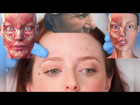 Видео: Ботокс ❤️ ботулинотерапия для начинающих ❤️ классическая коррекция токсином зоны межбровья ✅