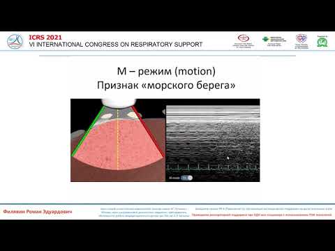 Видео: УЗИ легких на СМП Филявин Р.Э.