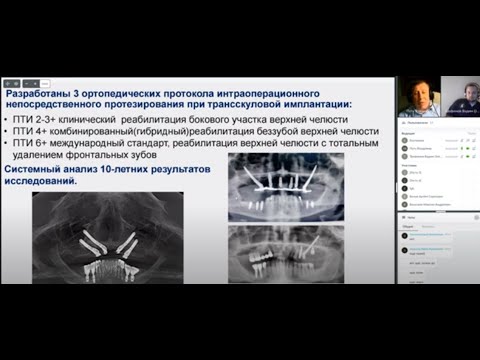 Видео: Имплантация в лунку удаленного зуба и немедленное протезирование