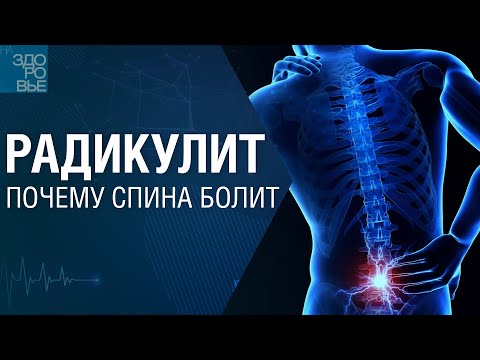 Видео: Радикулит. Почему спина болит. На здоровье 05.11.2022