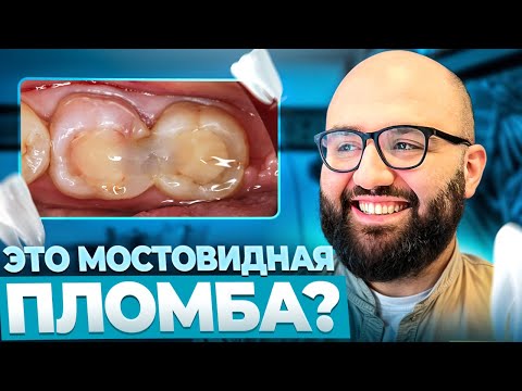 Видео: Лечим зубы — получаем стиль