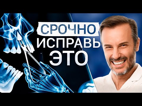 Видео: Ретинированный клык — ДО / ПОСЛЕ. Что делать, если зуб уже в носу?