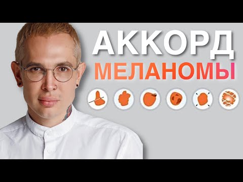 Видео: МЕЛАНОМА как распознать опасные родинки | ранняя диангостика