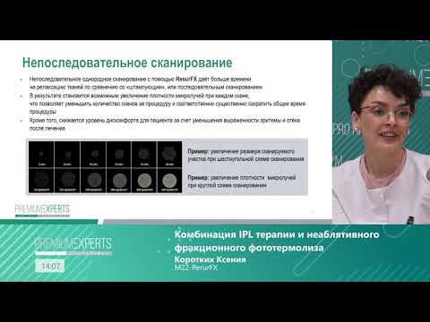 Видео: Мастер класс 9. Комбинация IPL-терапии и неаблятивного фракционного фототермолиза.