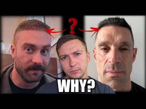 Видео: Почему знаменитости-миллионеры всё ещё делают неудачные пересадки волос