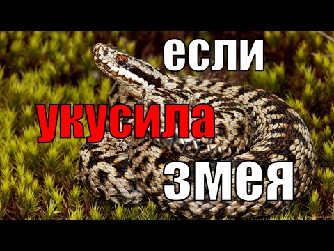 Видео: Выживание в лесу I Что делать, если укусила гадюка?