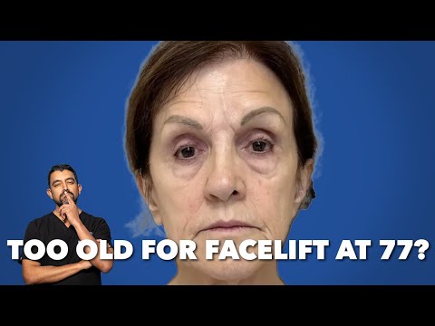 Видео: Слишком стары для подтяжки лица в 77 лет?