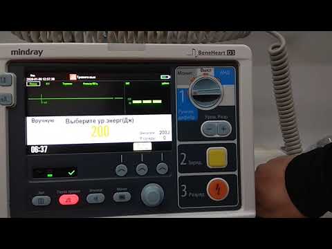 Видео: ДЕФИБРИЛЛЯТОР BeneHeart D3 MINDRAY
