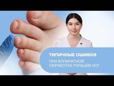 Видео: Типичные ошибки при аппаратной обработке пальцев ног