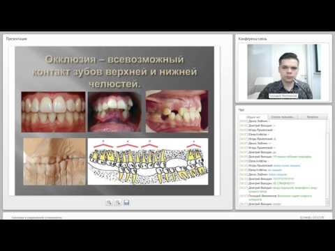 Видео: 2015 04 28 Окклюзия в современной стоматологии