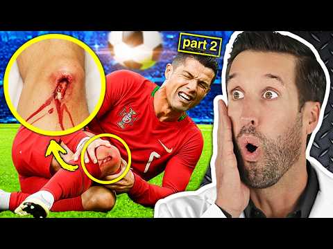 Видео: ВРАЧ смотрит на ХУДШИЕ травмы футбол #2