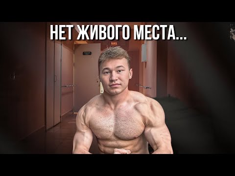 Видео: ТАТВОЛ СТАЛ ИНВАЛИДОМ В 20 ЛЕТ ! 22 ДИАГНОЗА