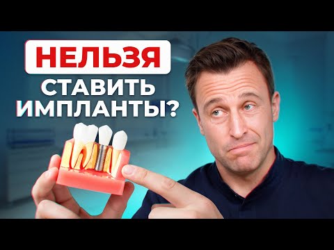 Видео: Самые ЧАСТЫЕ противопоказания для имплантации! / Все о пародонтозе и пародонтите