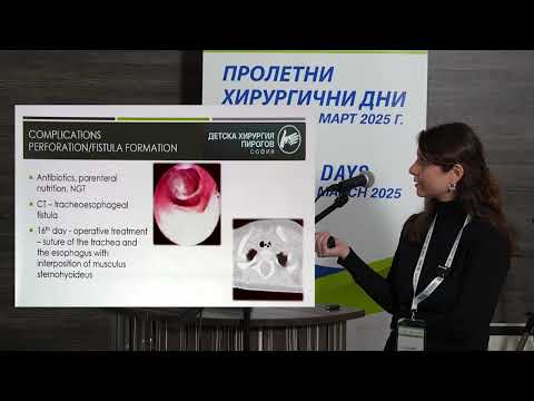 Видео: 47. Усложнения при поглъщане на плоски батерии в детска възраст