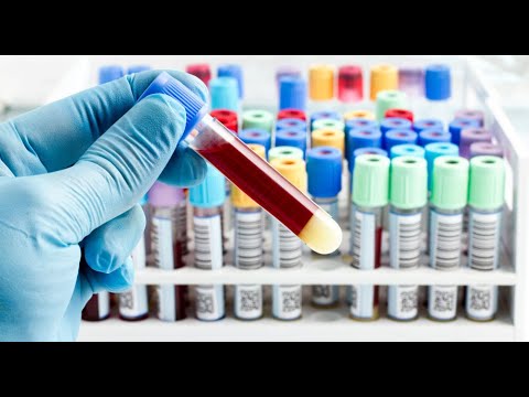 Видео: Вебинар по гематологии. Анемии. Нейтропениии.Лимфоаденопатии