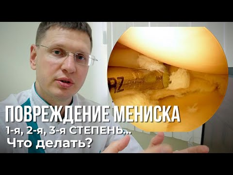 Видео: Что делать при повреждении мениска 1, 2, 3 ст коленного сустава?