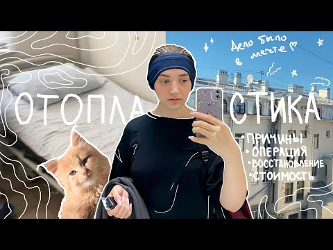 Видео: отопластика. моя история