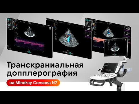 Видео: Мастер-класс по УЗИ сосудов головного мозга на Mindray Consona N7