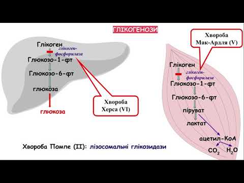 Видео: 5. Хвороби глікогену. Частина 2