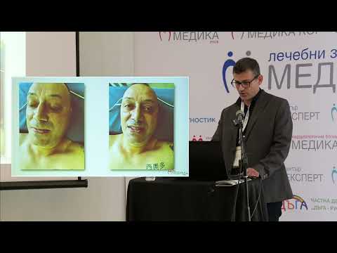Видео: 62. Тежки възпалителни заболявания от одонтогенен произход – прогноза и лечение в насока мултидис...
