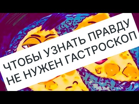 Видео: ГАРИ КЕРИ МУТНЫЕ #СамвелАдамян #saveliyad #ГрандеНико #ГарикКери 
