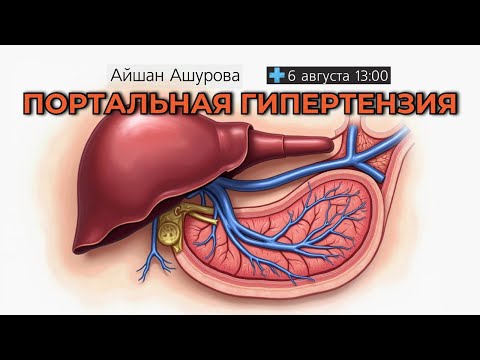Видео: Портальная гипертензия