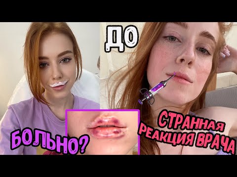 Видео: УВЕЛИЧИЛА ГУБЫ/ВСЕ ПОШЛО НЕ ПО ПЛАНУ