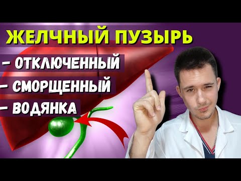 Видео: Отключенный желчный пузырь | Водянка желчного пузыря
