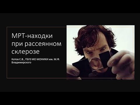 Видео: МРТ-находки при рассеянном склерозе