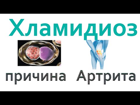 Видео: Все врачи знают!!! Хламидиоз- одна из причин АРТРИТА. Болезнь Рейтера