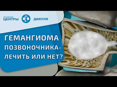 Видео: Гемангиома позвоночника. Вопрос-ответ.