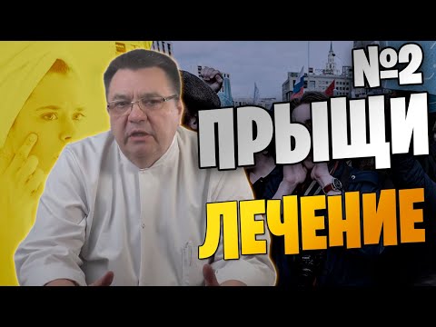 Видео: "Прыщи" - лечение №2. Доктор Косов.