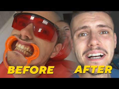 Видео: немам веќе жути заби